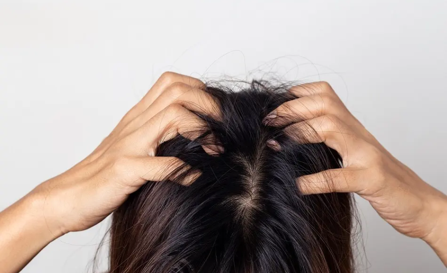 Do I Have Lice or Am I Paranoid? Understanding the Signs and Finding Peace of Mind